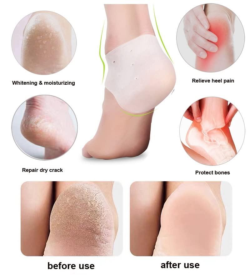 Shoppingekart Heel Pain Relief Products For Women Anti Crack Silicon Gel Heel And Foot Protector Moisturizing Socks for Foot Care,leg pain relief products And Heel Pad for Men & Women(Length Half|Free Size|10 Pair)