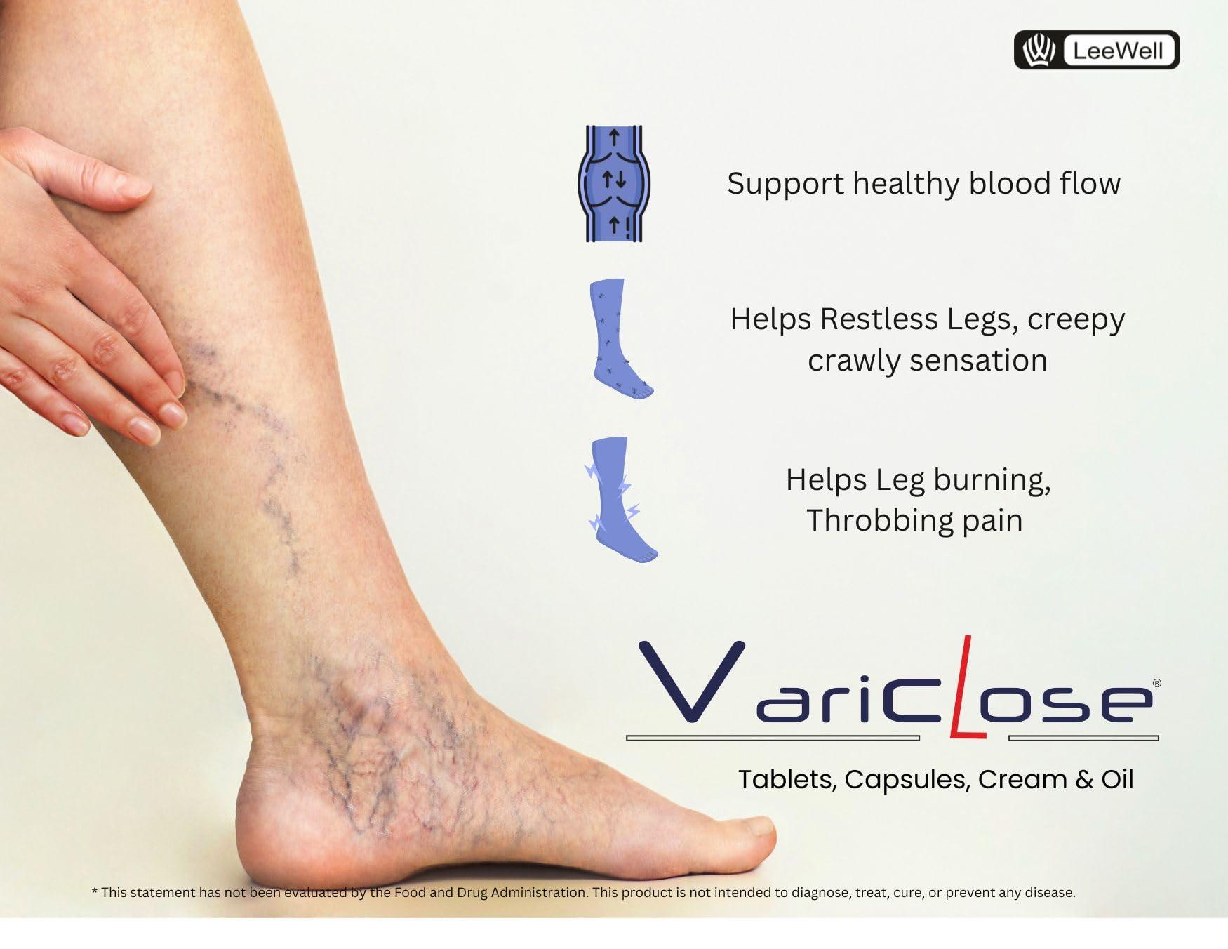 VARICLOSE Variclose Support Varicose Veins, Spider veins | Diosmin, Hesperidin, Horse Chestnut extract (Aescin), Butchers broom extract (Ruscogenins) | Plant based Foot, Legs Vascular Micro Circulation Support Supplement -60 Tablets