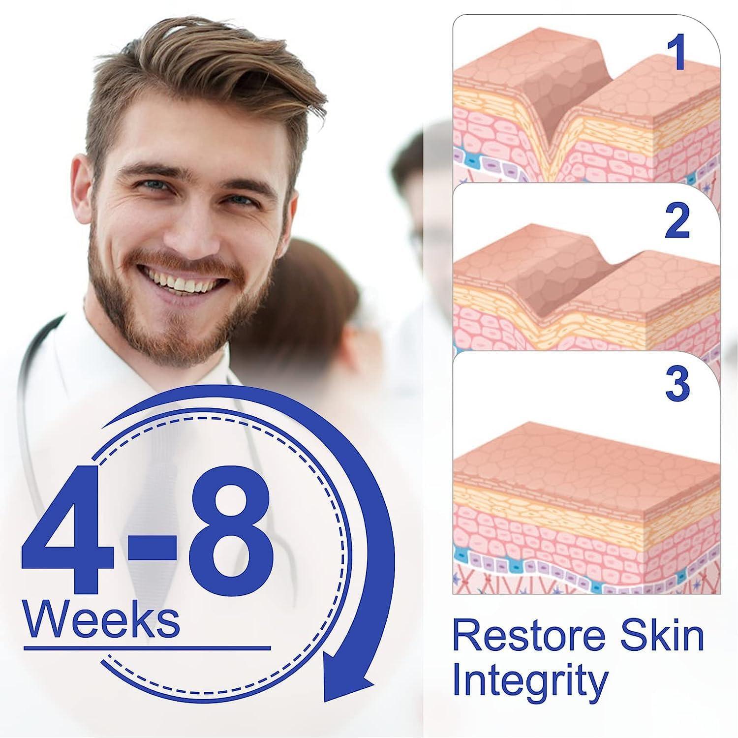 LUPINEZ LUPINEZ Transparent Medical Silicone Gel Tape for Scar Removal,Scar Transparent for Surgical Scar, Silicone Scar Sheets, Silicon gel sheets for Scars