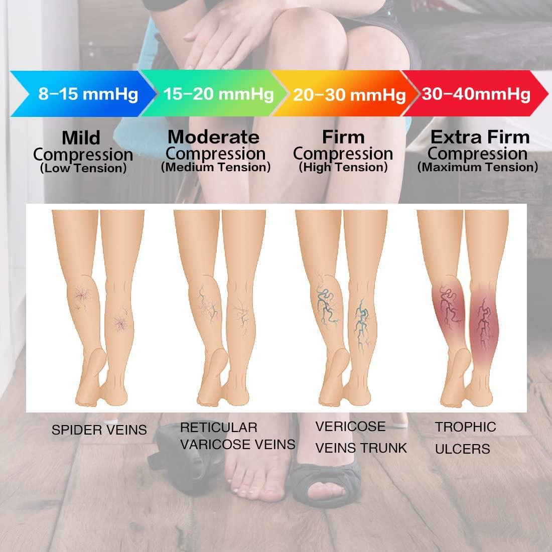 KASTWAVE Open Toe Compression Socks, 20-30 mmHg Toeless Compression Stockings, Knee High Calf Compression Socks, Support Hose for Varicose Veins, Nursing & Maternity, Relief Shin Splints, Men & Wome, (1 Pair)
