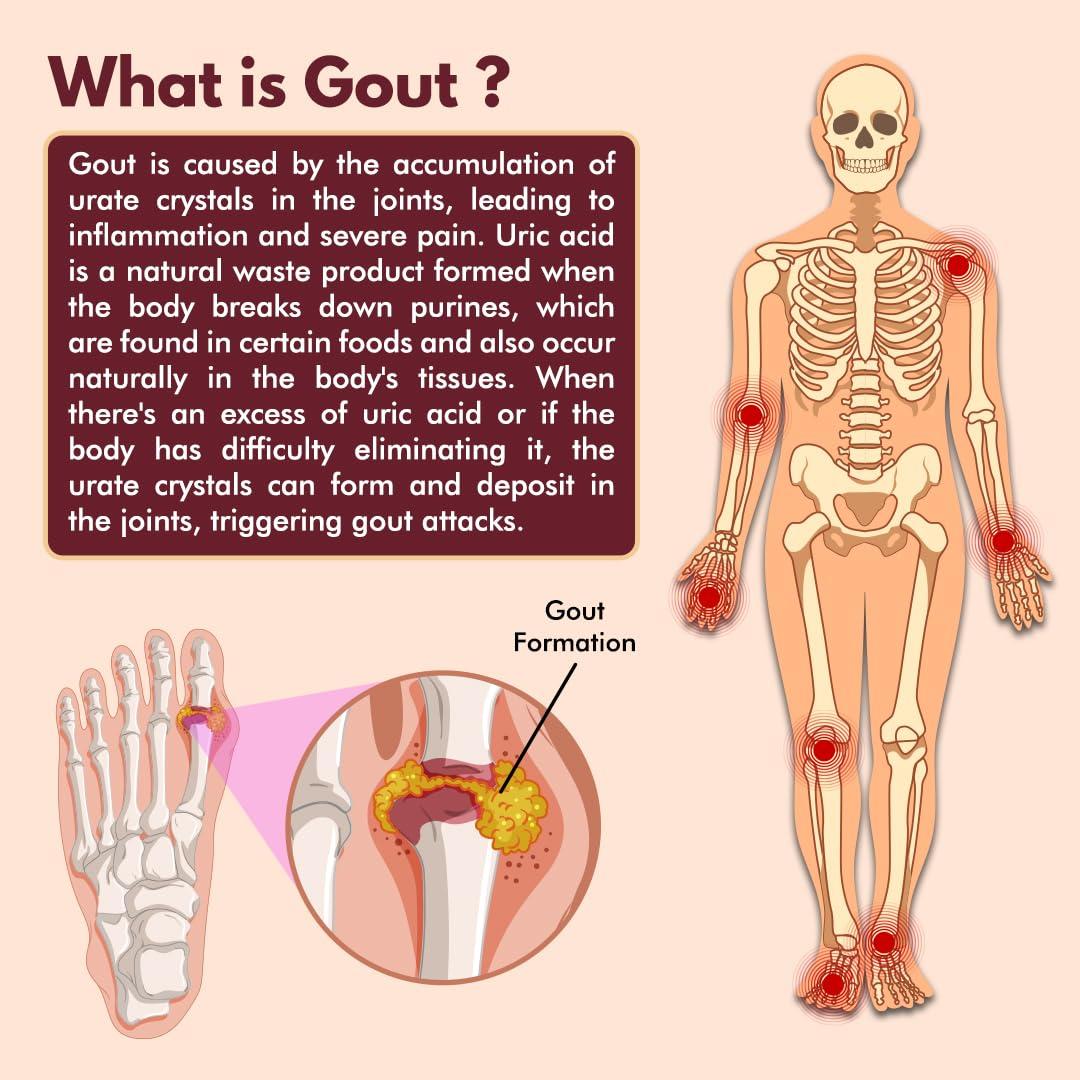 ad ALICANTO DRUGS Uric Acid Capsules, Herbal Joint Support Supplements, Uric Acid for Pain Relief, Ayurvedic Proprietary for Gout pain Joint Support