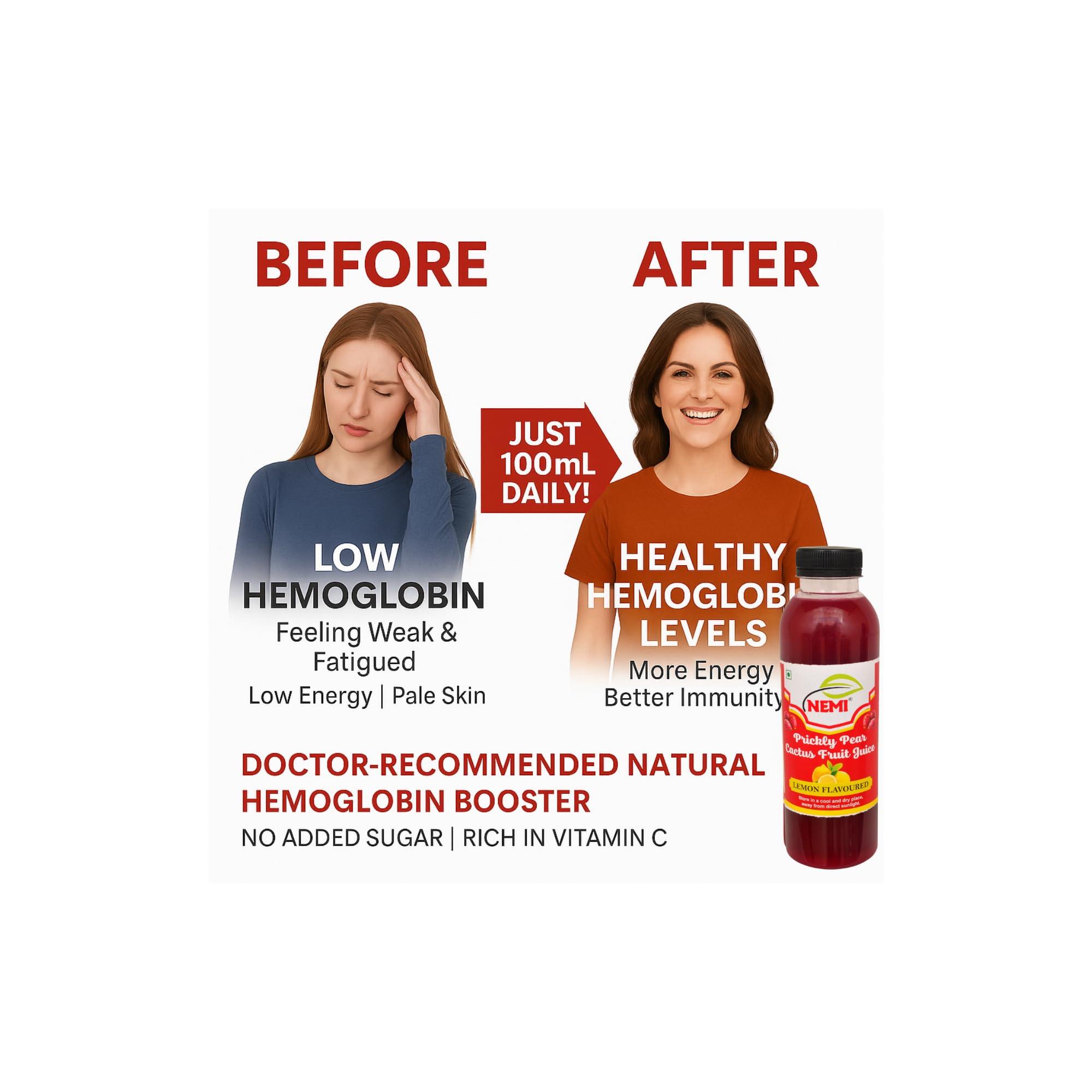 NEMI Nemi Organic Prickly Pear Cactus Juice - Rich in Hemoglobin Sugar Lemon, Vitamin C - Findla Juice Original Pack of 2