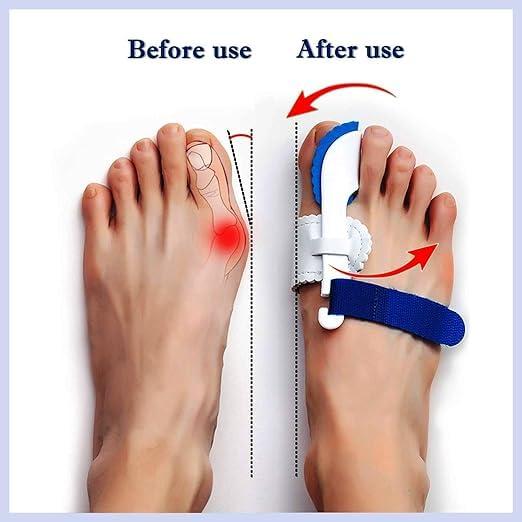 black sparrow black sparrow Good Night Bunion Big Toe Joint Bunion Splint Pads for Hallux Valgus Hallux Valgus Corrector Valgus Correction Bunion Support Splint Valgus And Bunion Valgus
