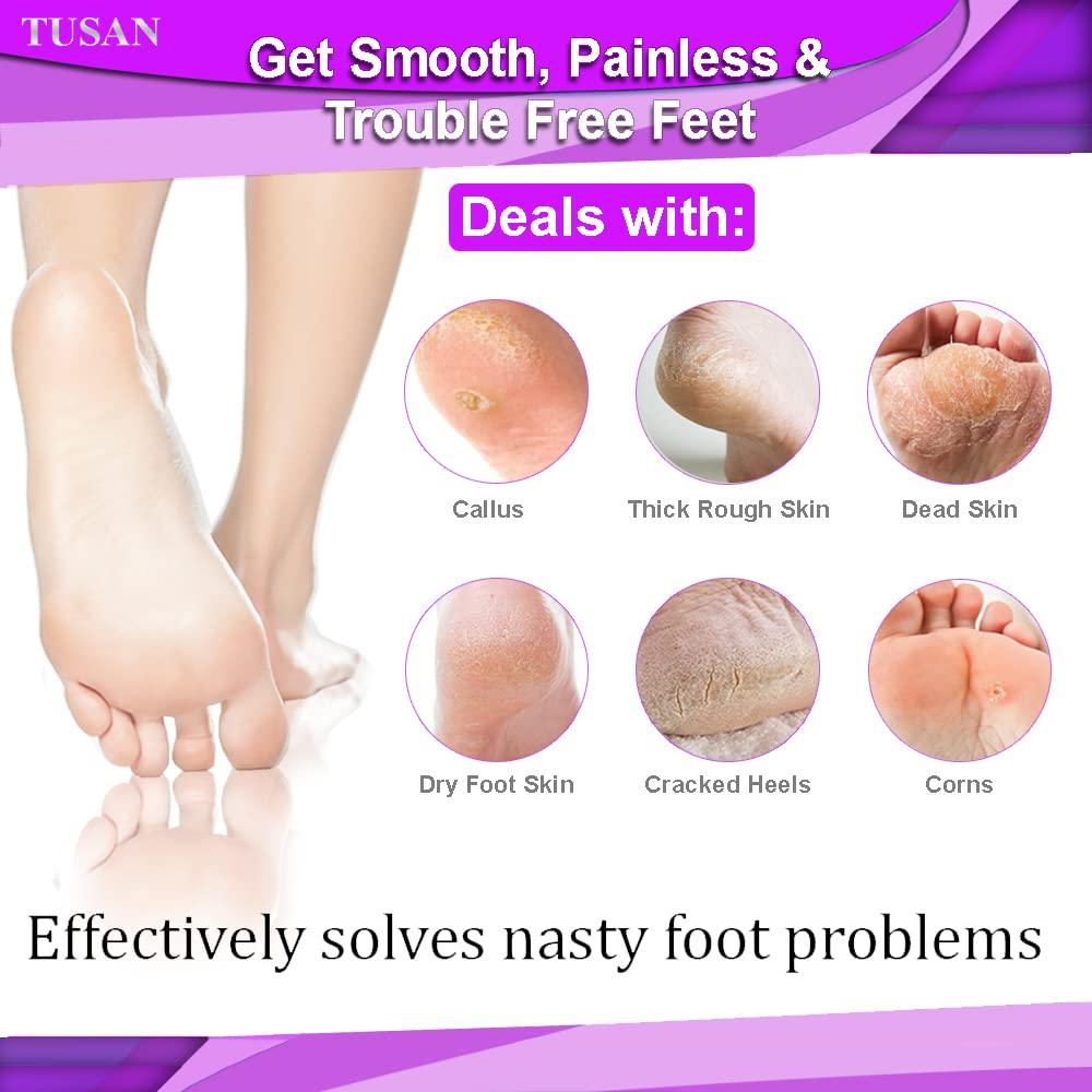 TUSAN TUSAN Premium Foot Scrubber For Dead Skin | Pedicure Brush Feet Dead Skin Remover Double Sided Wooden Callus Remover For Feet, Repaire Cracked Heels, Dry and Thick Rough Skin, and Foot Corns.