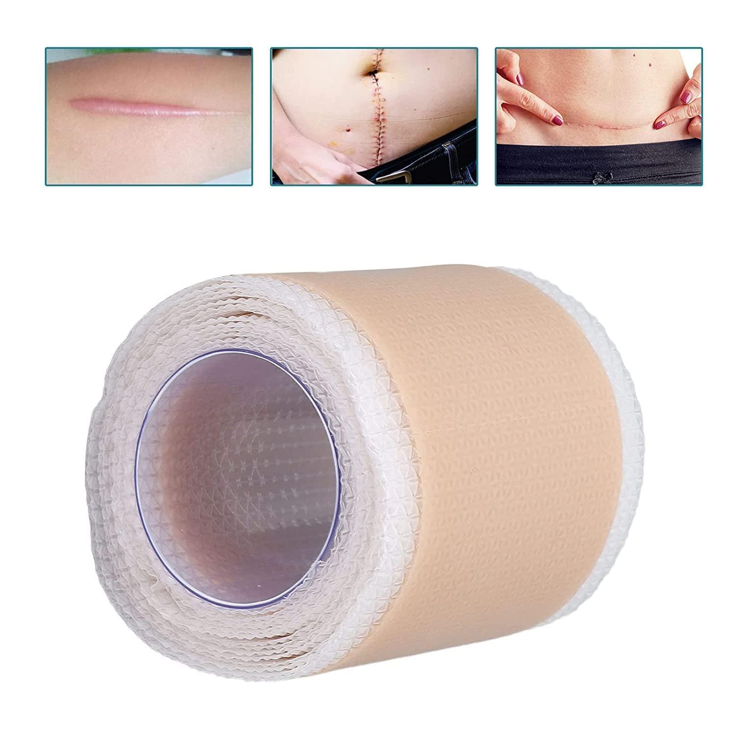 CLOSAL CLOSAL® 1 Roll Silicone Scar Sheets Waterproof Cica Care Gel Sheets Wound Repair Desalination Strip Scar Removal Sticker for Surgery Injury Burns Scars