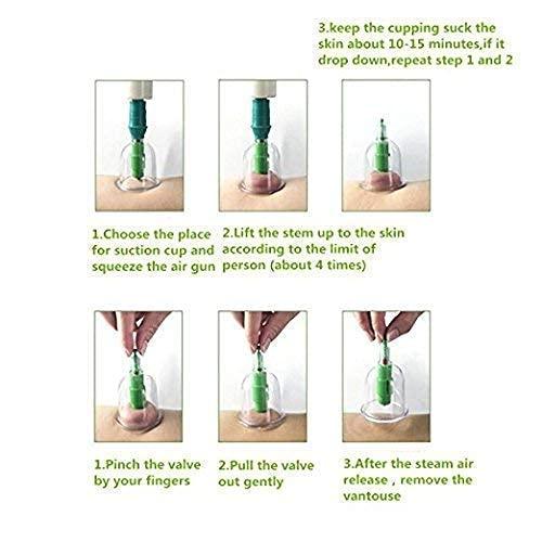 Kesariyaji Vacuum 12 cupping Medical Therapy Magnetic Machine Suction Acupressure Machine…