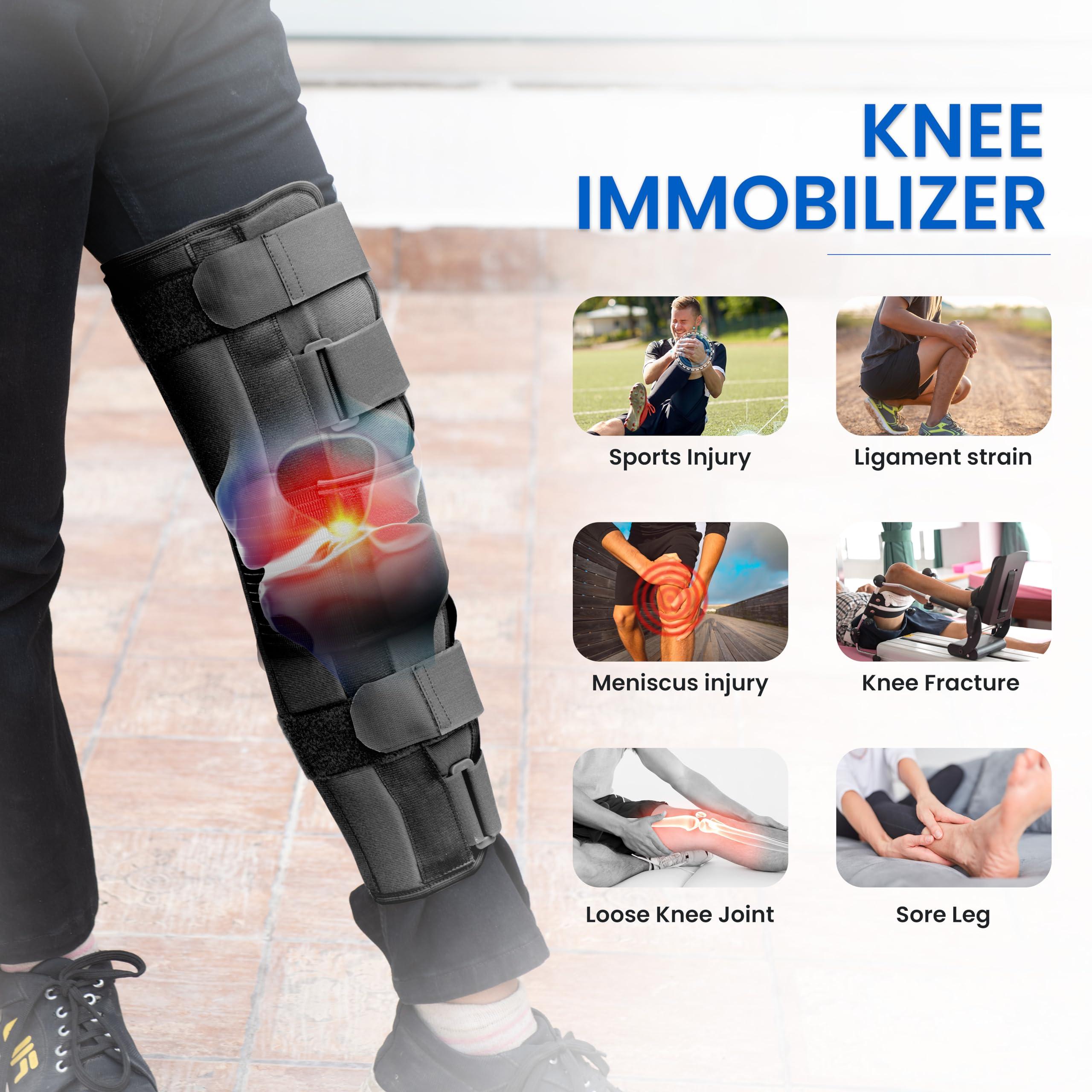 Wonder Care Wonder Care Knee Immobilizer Brace for Knee support for dislocation injuries ligament tear wraparound knee stabilizer splint for men & women (19 long) (S)