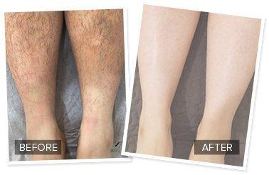 Param Param Electric Hair Remover Finishing Touch Pain-Free Plastic Shaver, Multicolour