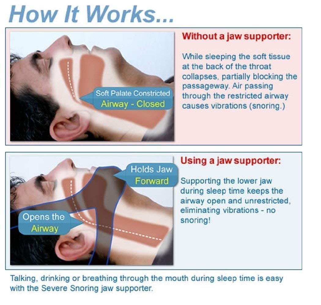 divinezon Divinezon Anti Snoring Chin Strap for Men & Women, 25.20 x 3.20 x 12.30 CM (Adjustable Size, Multi Color)