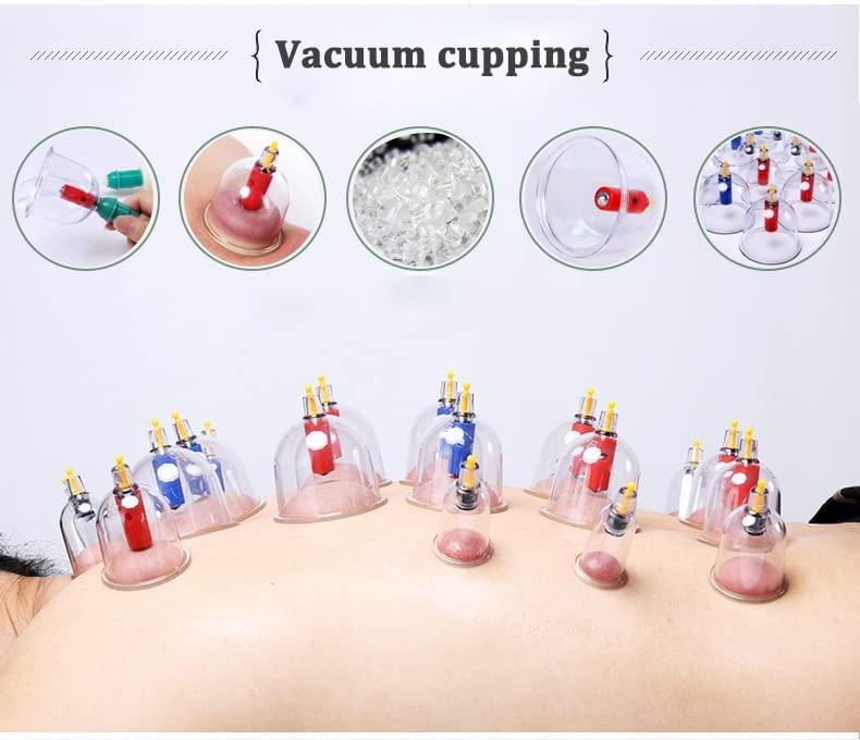 AHCS AHCS Kangzhu 24-Cup Biomagnetic Chinese Cupping Therapy Set