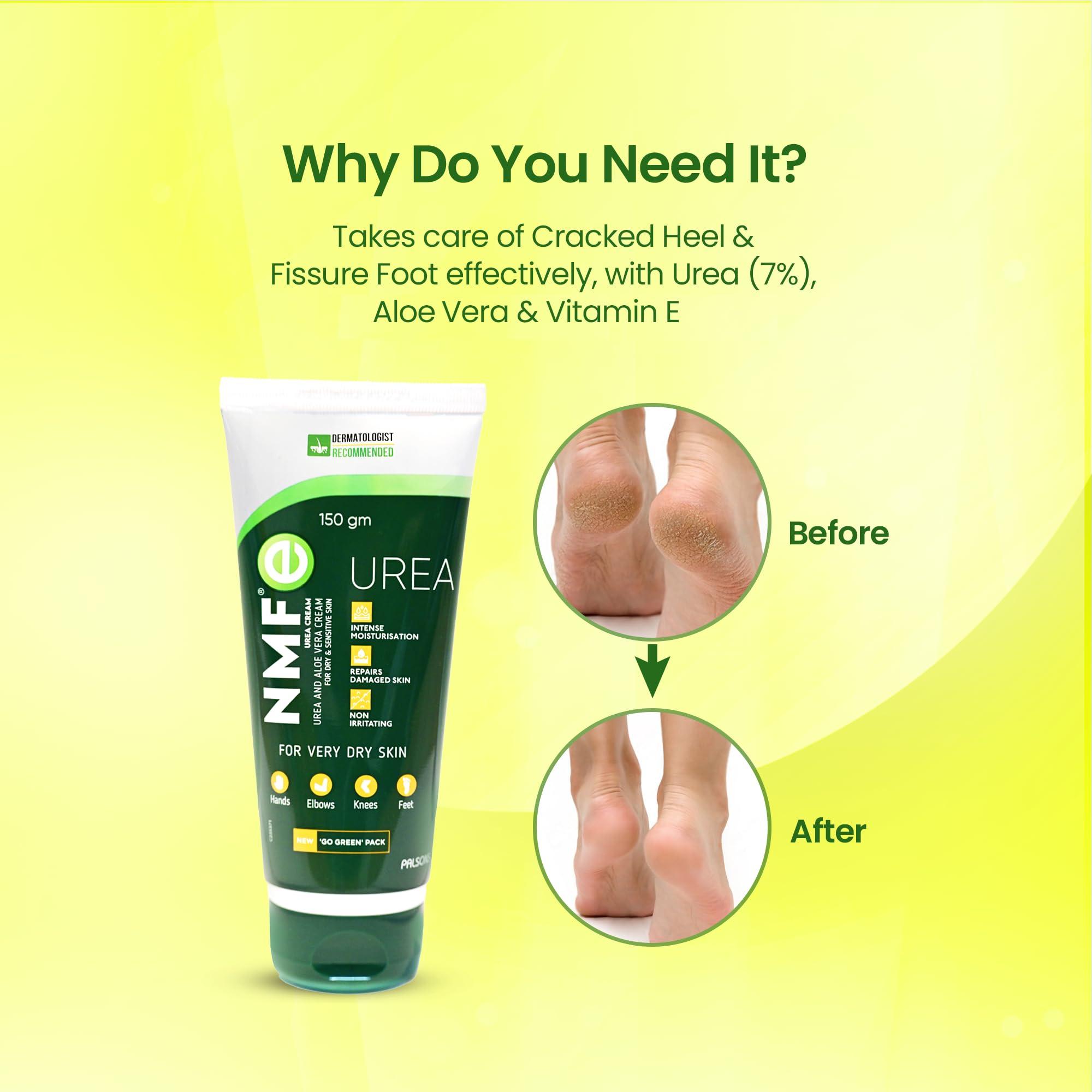 NMFe UREA CREAM NMFe Urea Cream 150 gm For Intense Moisturisation with Urea 7% & Aloe vera for thick and dry skin | Truly the Healing Moisturiser | For very dry skin | Takes care of cracked heels & Fissure feet effectively