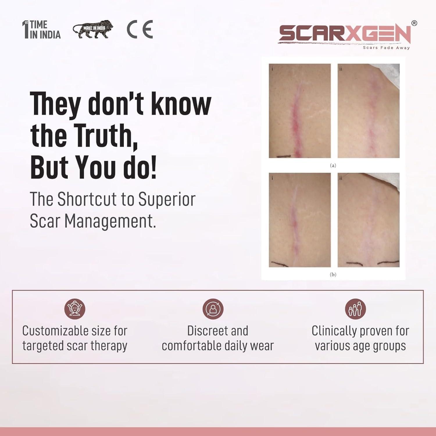 SCARXGEN Scarxgen Silicone Gel Sheet | Scar Sheet | Scars, Cuts and Scrapes, Laparoscopic scar | Reusable and Washable Sheet | Keloid and Hypertrophic scar I Visible scar reduction (3CMX20CM(BOX OF 1 UNIT))