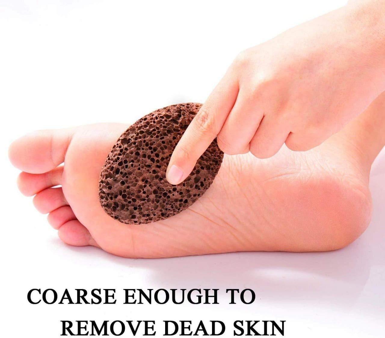 RUSTIC RITUALS best of nature for you! Rustic Rituals Lava Pumice Stone for Foot Callus Knees and Elbow| Pedicure- Callus Remover for Feet & Hands - Pedicure Tool Exfoliation to remove dead skin- Pack of 2