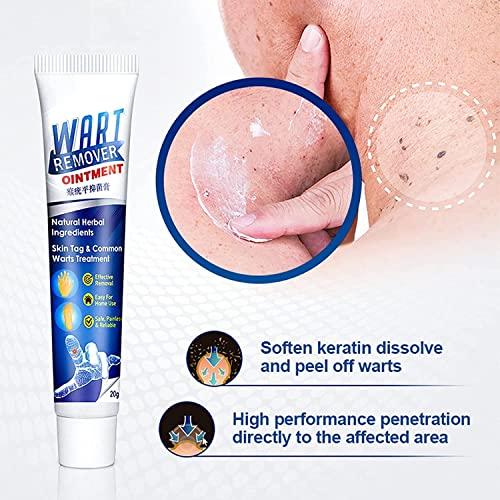 1 Warts Remover Cream 20g Extract Skin Face Tag Extract Corn Treatment Ointment Painless For Men Women and Childrens - (Pack of 1)