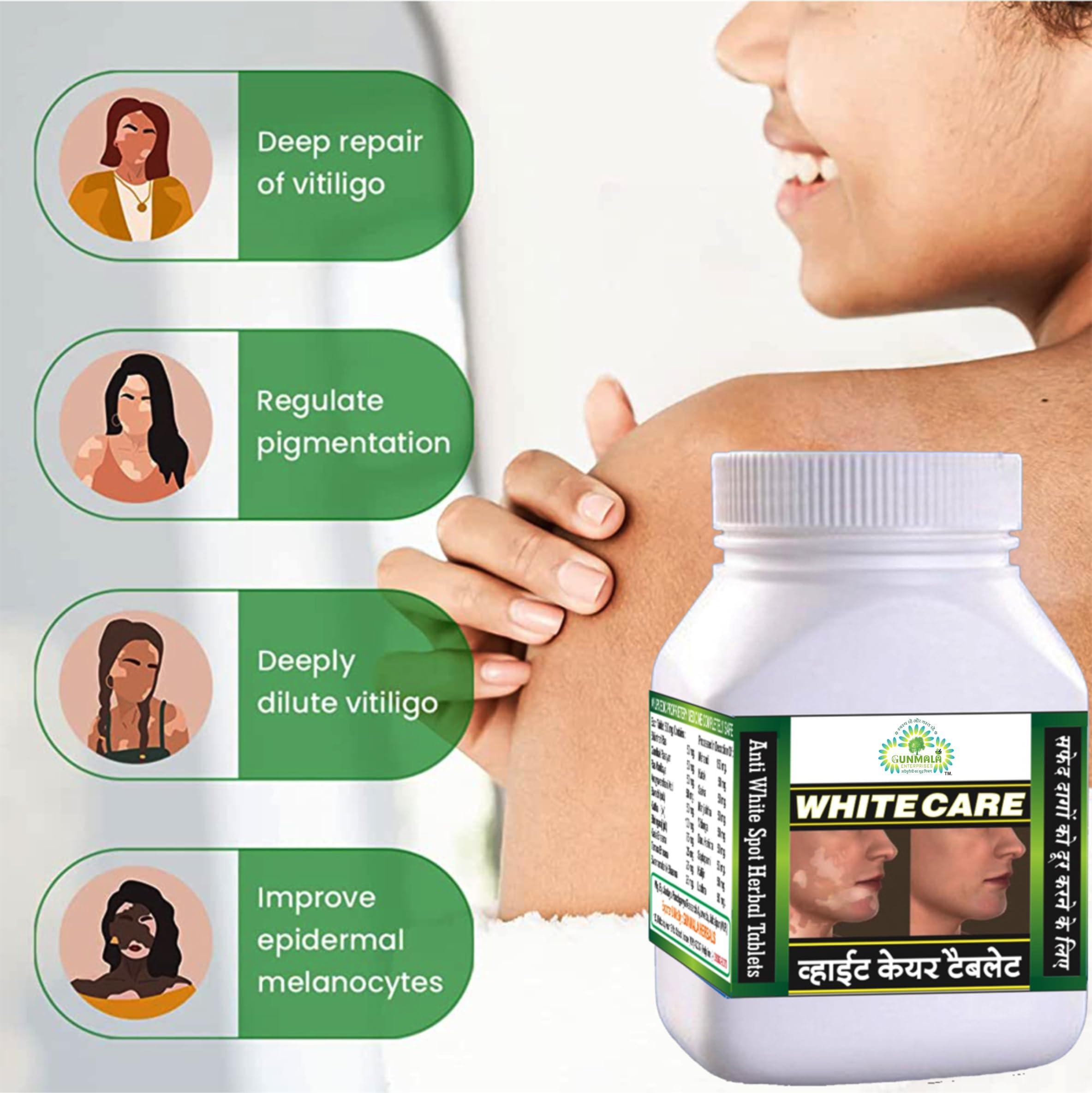 GUNMALA ENTERPRISES White Care Tablet - 50 TAB. Pack Of 1