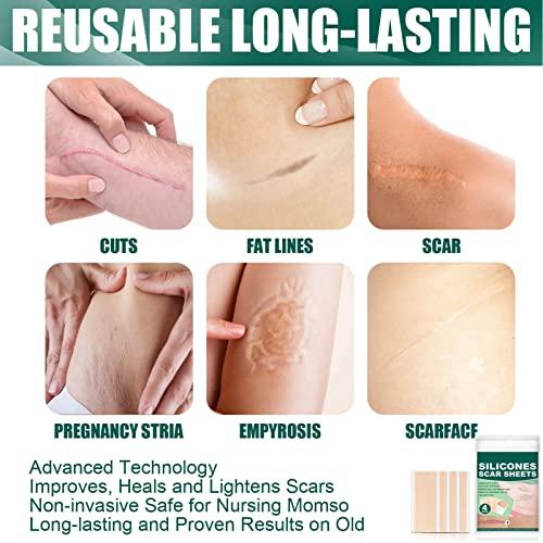 Folanda 4 Pcs Silicone Scar Sheets, Ultra Thin Breathable Silicone Gel Scar Tape, Soften and Flattens Scar Removal Strips for C-Section, Surgery, Burn and More, Skin Scar Concealing Tape
