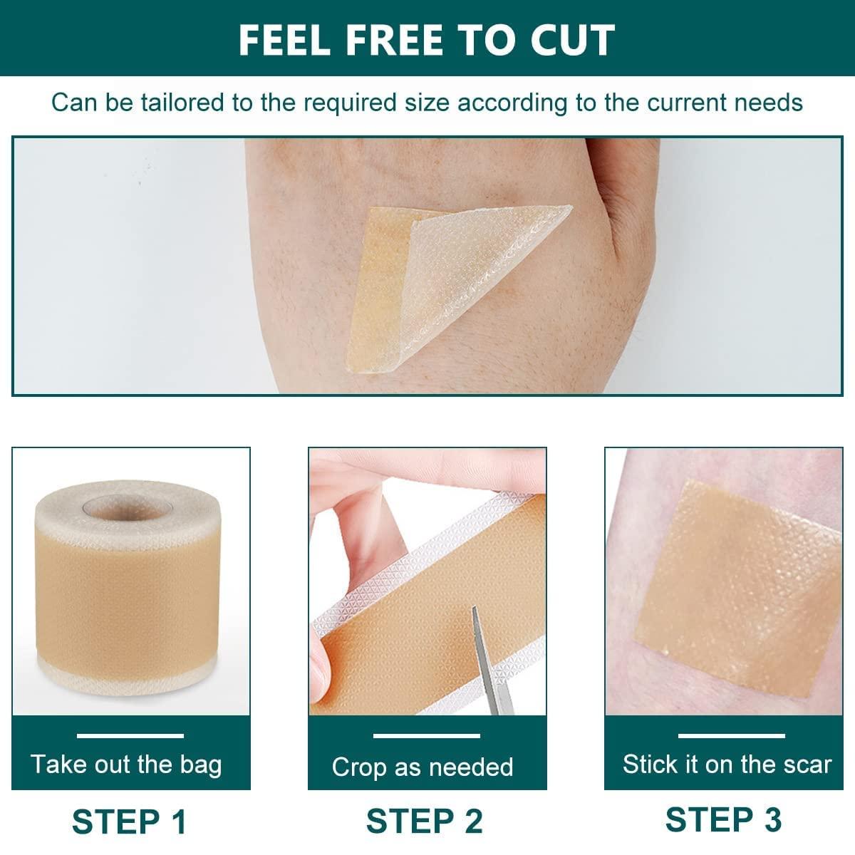 CLOSAL CLOSAL® 1 Roll Silicone Scar Sheets Waterproof Cica Care Gel Sheets Wound Repair Desalination Strip Scar Removal Sticker for Surgery Injury Burns Scars