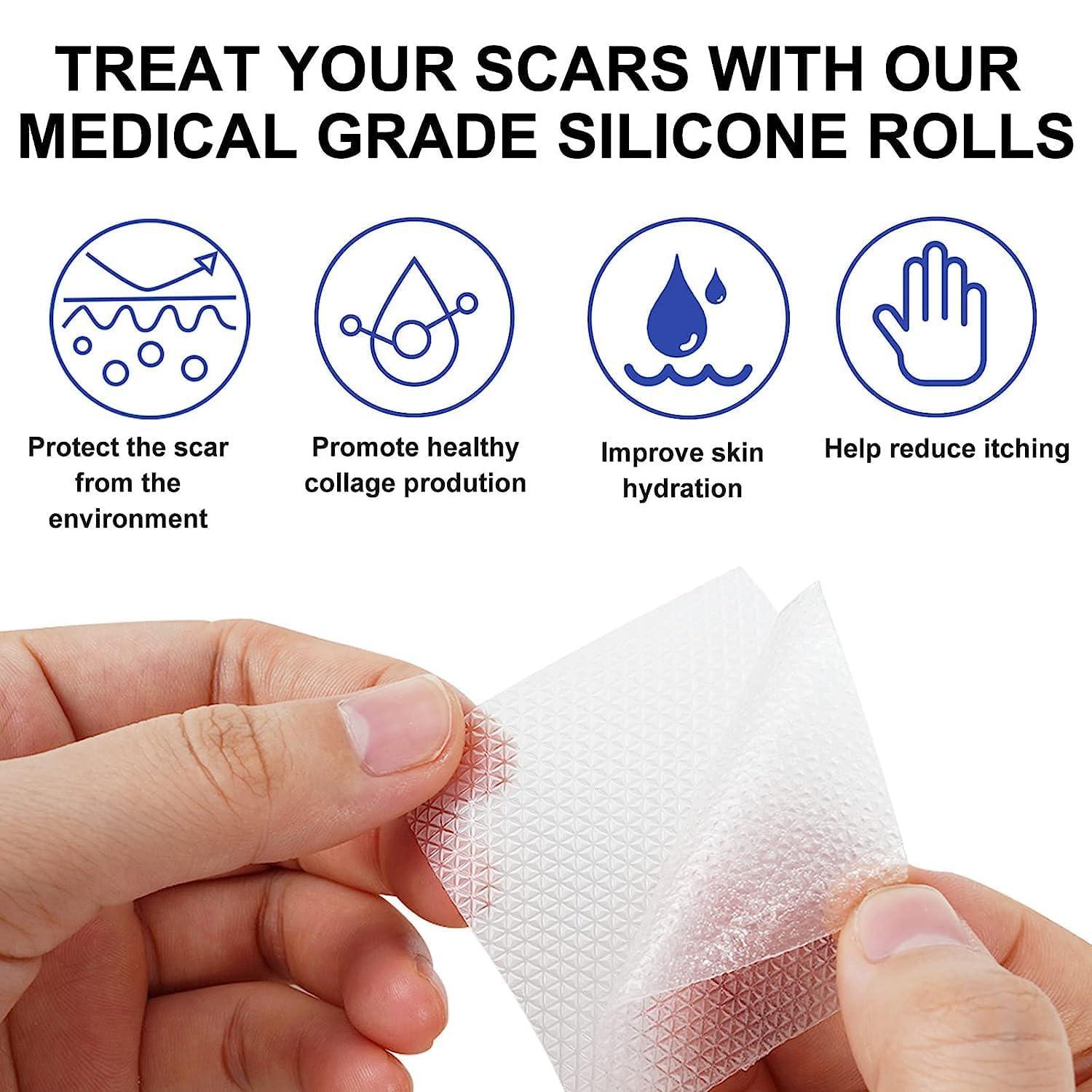LUPINEZ LUPINEZ Transparent Medical Silicone Gel Tape for Scar Removal,Scar Transparent for Surgical Scar, Silicone Scar Sheets, Silicon gel sheets for Scars