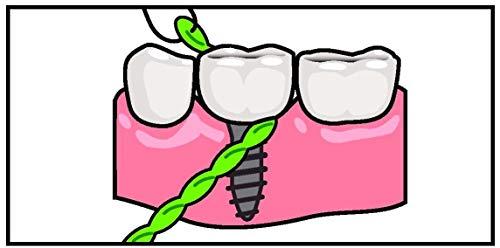 iDontix Idontix X-Floss 30 Strands Easy Bridge And Implant Floss by Idontix