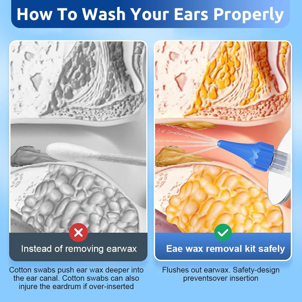 HANNEA HANNEA Manual Ear Irrigator Ear Wax Cleaner Long Pipe Ear Wax Removal Ear Canal Irrigator for Adults & Kids Ear Cleaning Rinser with 10Pcs Single Hole Nozzles, 1 Five Hole Nozzle, 250ml Water Cup