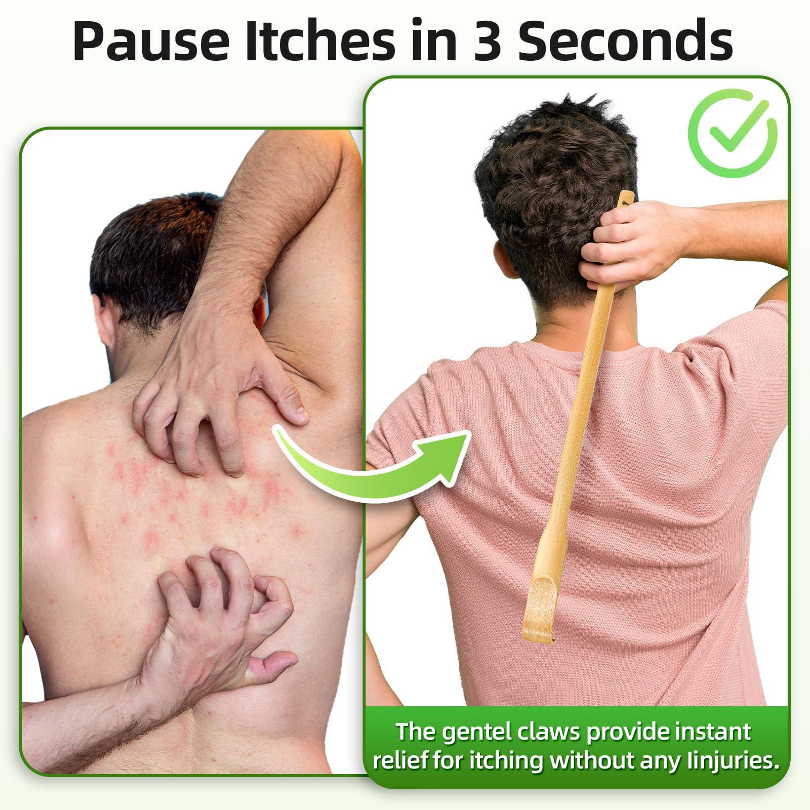 Renook Renook Bamboo Wooden Back Scratchers, 17in, Pack of 5, Best for Pregnant Women and People Who Need Longer Hands, Provide Instant Relief from Itching