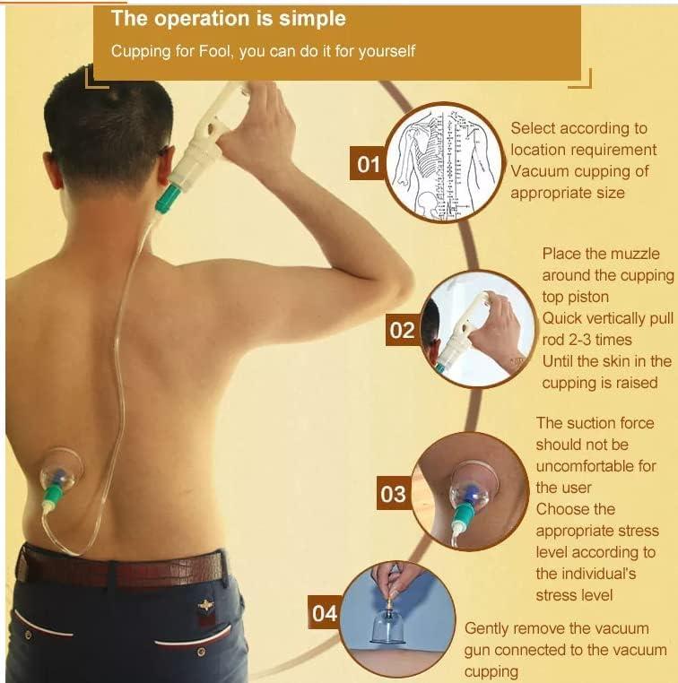 ANCS ANCS Acupressure 24 Vacuum Cups Chinese Medicine Magnet Therapy Cupping Set Acupuncture Manual Massager for Pain Relief Multicolor