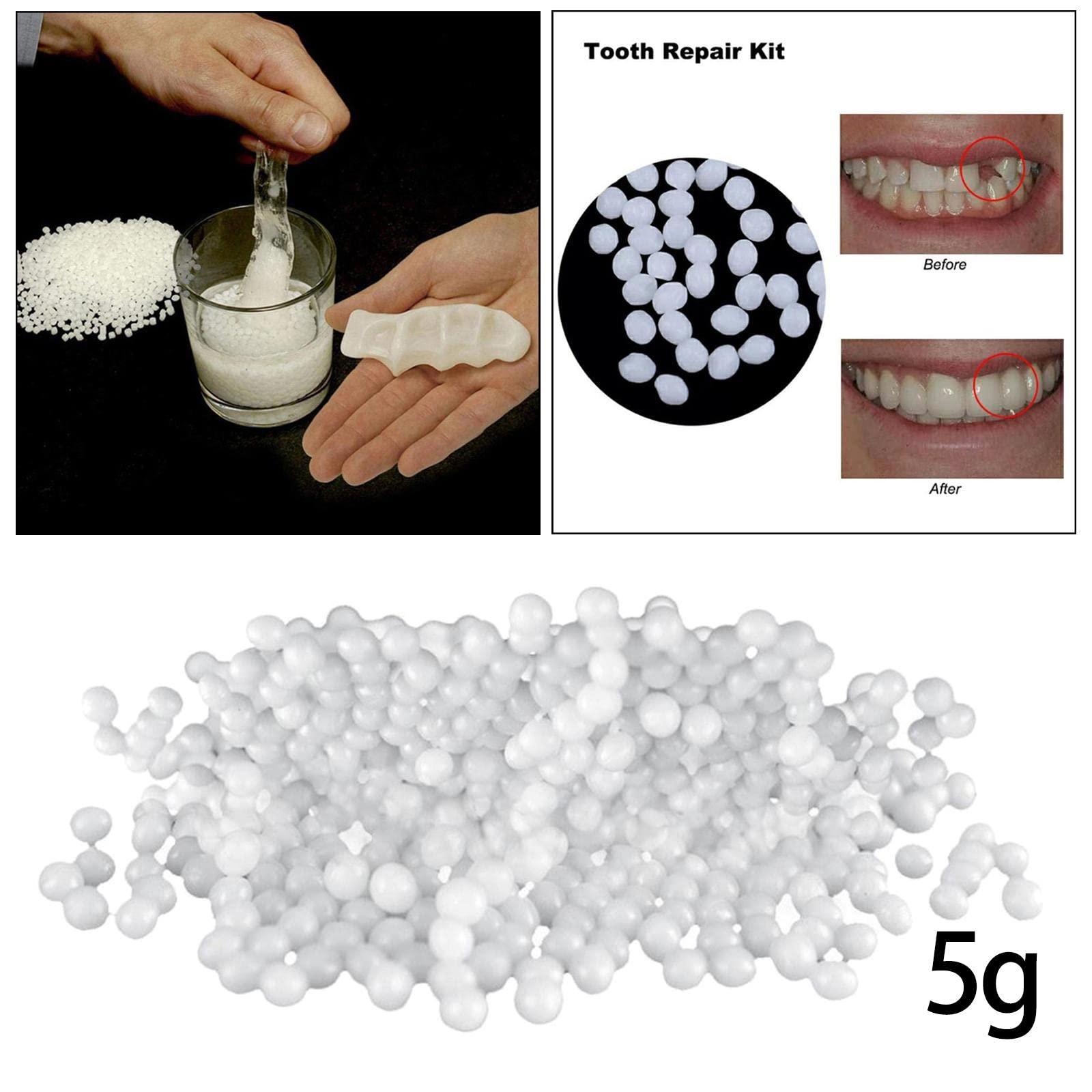 UJEAVETTE UJEAVETTE Temporary Teeth Repair Kit Filling Fix The Missing And Broken Tooth Moldable