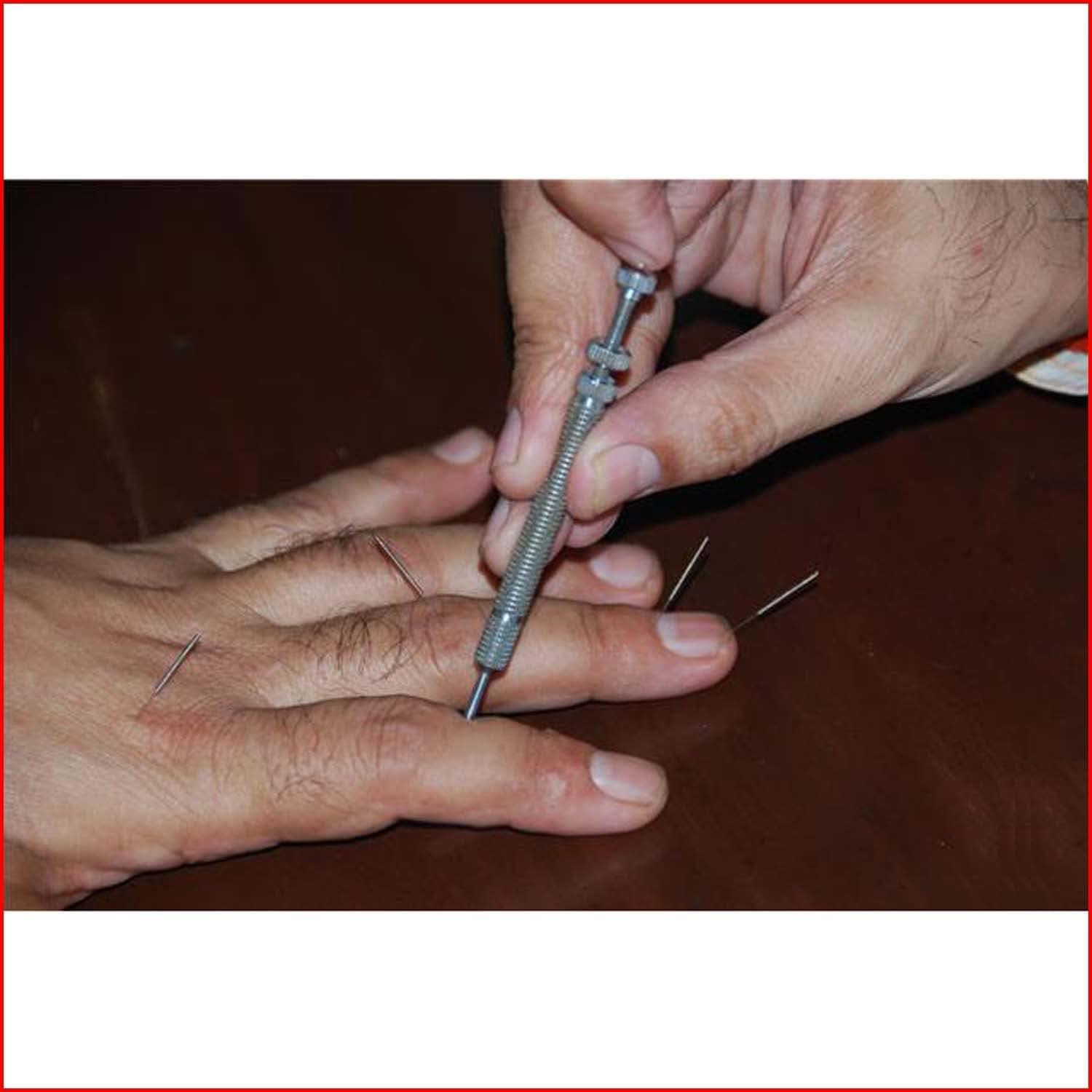 ANCS ANCS Sujok Acupuncture Needle Inserter - Six key