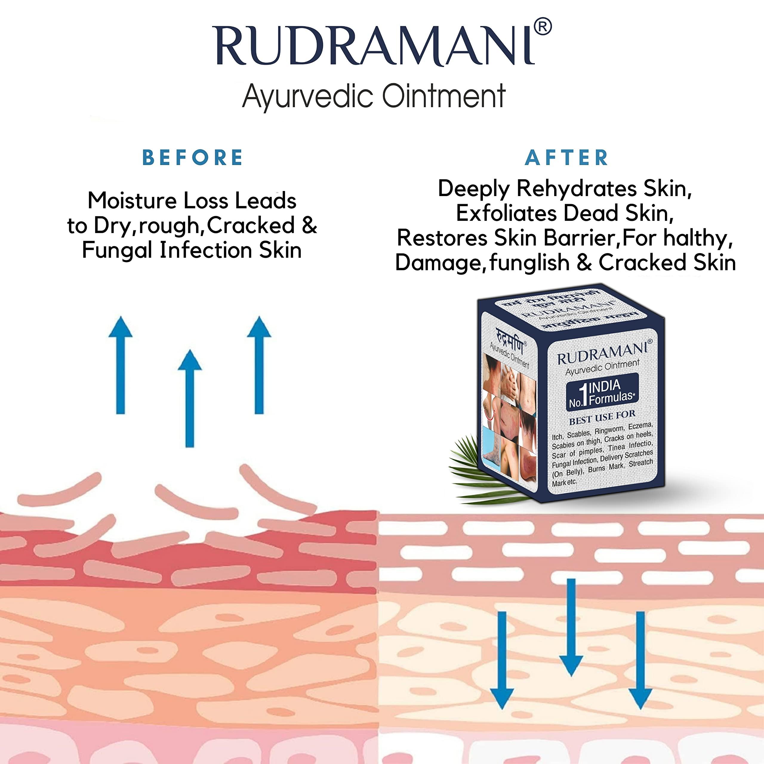 Generic Rudramani Marham Malam Dad Khaj Khujli fungal Ointment - for Ringworm, itching & Skin Infection, Skin Tretment, Skin Care. (25GRAM)