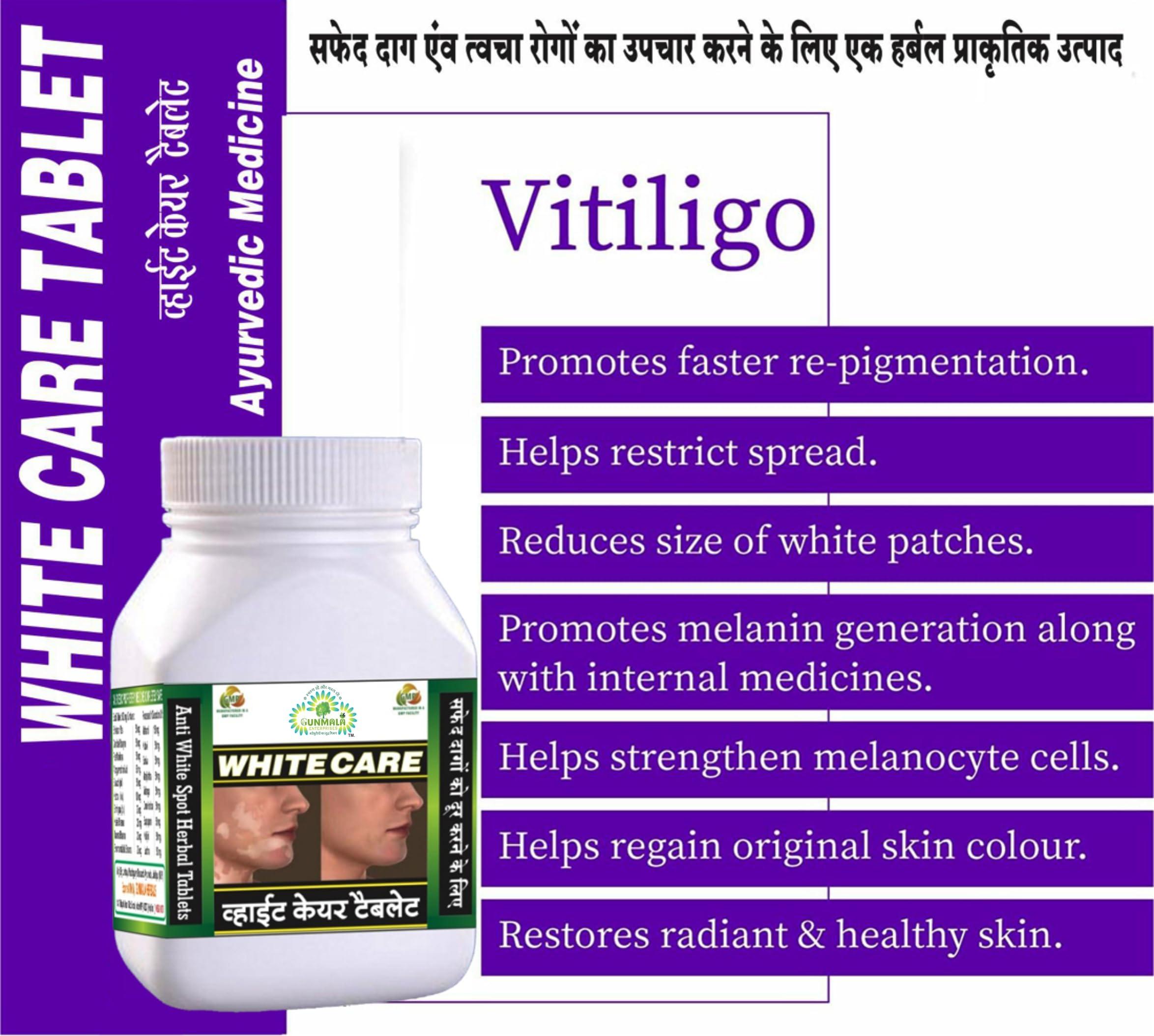 GUNMALA ENTERPRISES White Care Tablet - 50 TAB. Pack Of 1