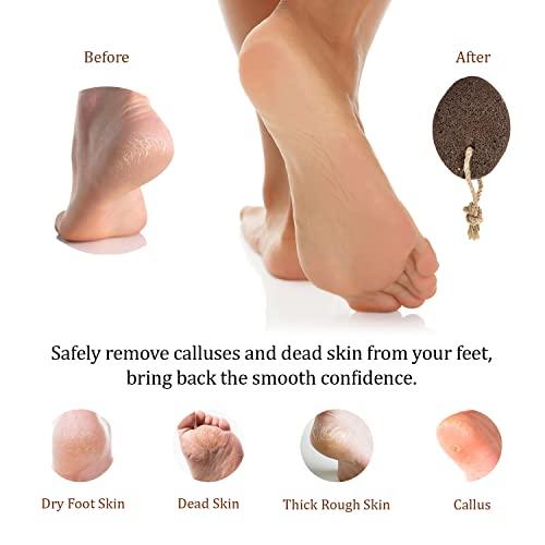 Pumice Valley Pumice Stone for Feet - Natural Lava Foot Stone with New Eco-Friendly Holder - Callus Warts Corn Removal - Pedicure Exfoliator for Dry Dead Skin | Heels | Elbows | Hands - Healthy Foot Care Scrubber