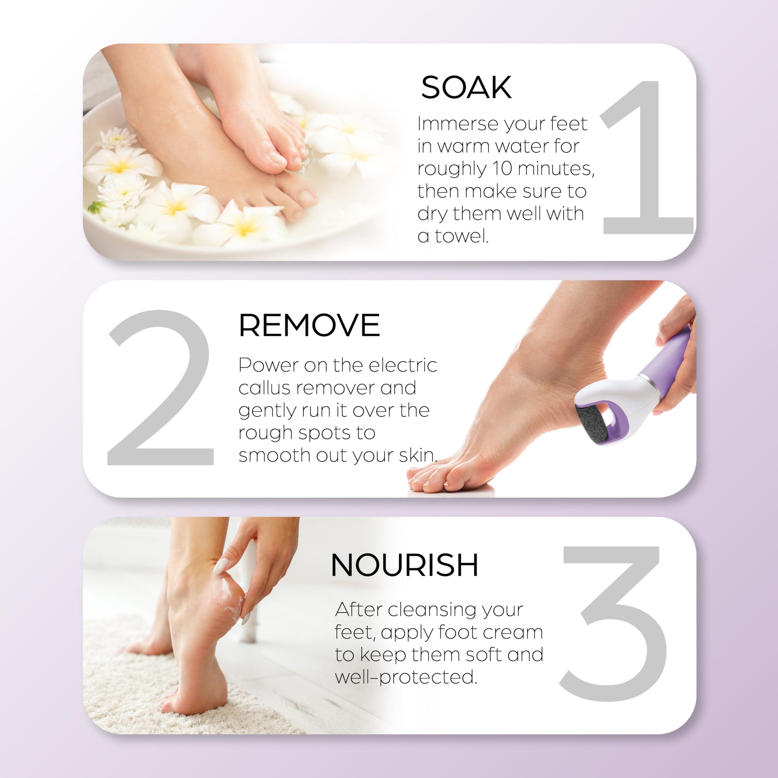 Bella Ciao Bella Ciao Cordless Callus Remover for Feet|Batt Oper 2 Speed Foot Scrubber for Softer Feet|Spinning Pumice Stone for Feet w/LCD Display|Includes an Extra Pumice Head|Foot File, Callous Remover Tool