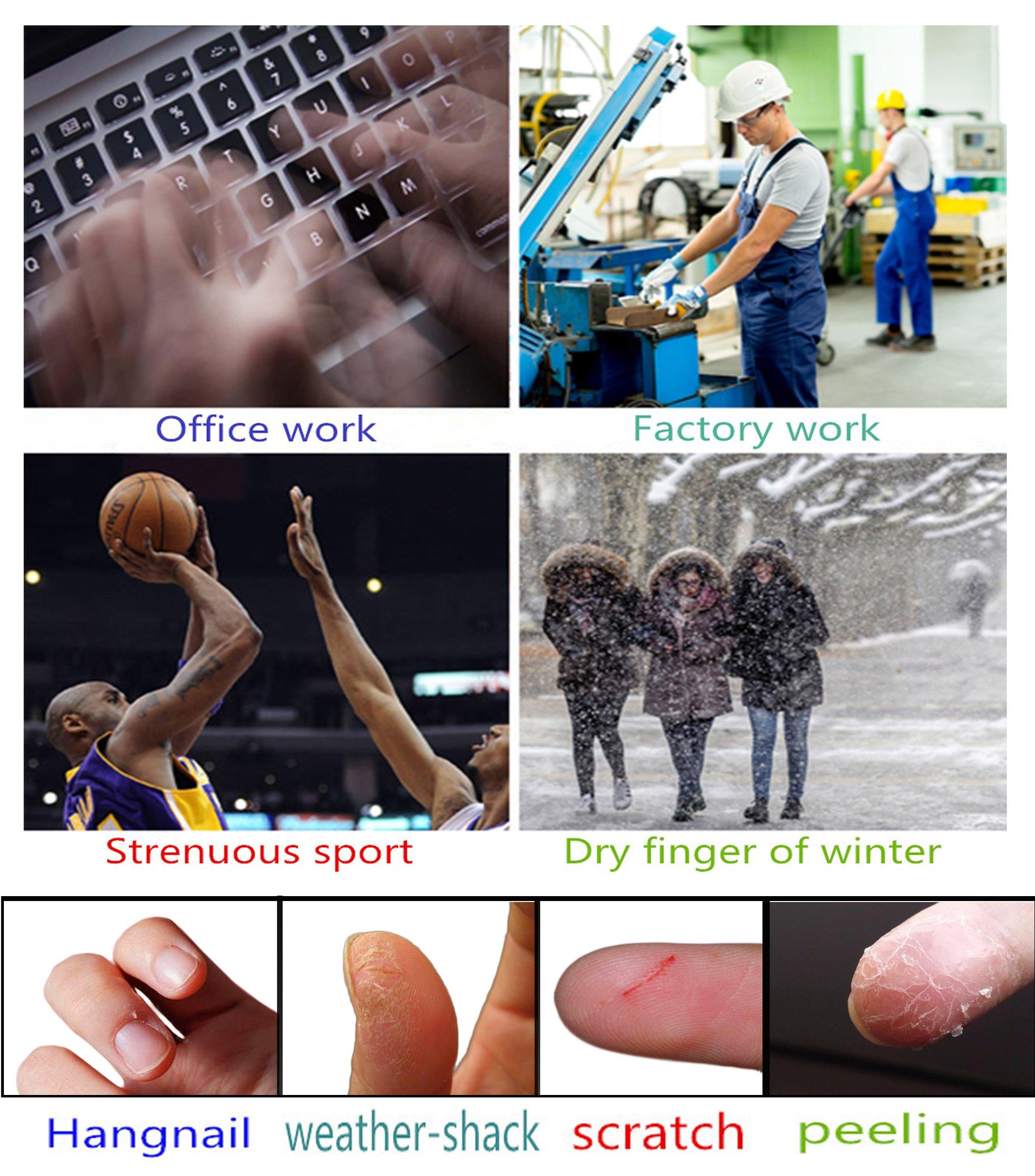 ERGOfoot ERGOfoot 6 Pack Toe Caps Close Finger Toe Sleeve Tubes Toe Protectors Gel Rubbing Tube to Prevent Bunions, Hammertoes, Callus, Corn, Blisters(Diameter 1.5cm)