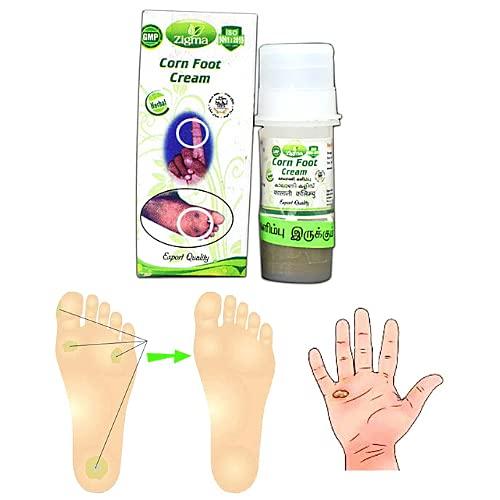 CTM EXPORTS CTM EXPORTS Zigma Ointment For Kaal Aani Cream (500Mg) - (Pack Of 500Mg X 2) - Foot Corn Remover, Hand Corn Remover, Callus Remover, Kapasi Remover Cream/Malam (Pack Of 2)