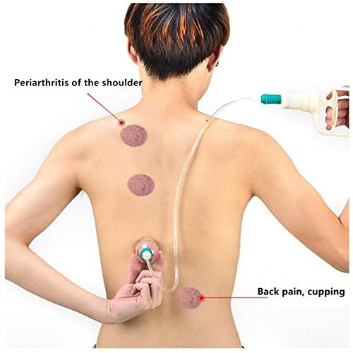 POWEREST POWEREST Chinese Traditional Healthy Body Vacuum Acupuncture Cupping Massage Therapy Set for Cellulite, Headache, Heat stroke, Backache, Naval Imbalance - Set of 6