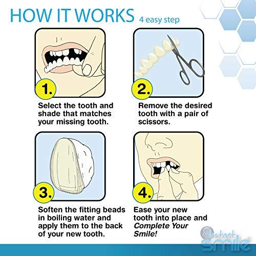 Instant Smile Instant Smile Complete Your Smile Temporary Tooth Replacment Kit - Replace a missing tooth in minutes