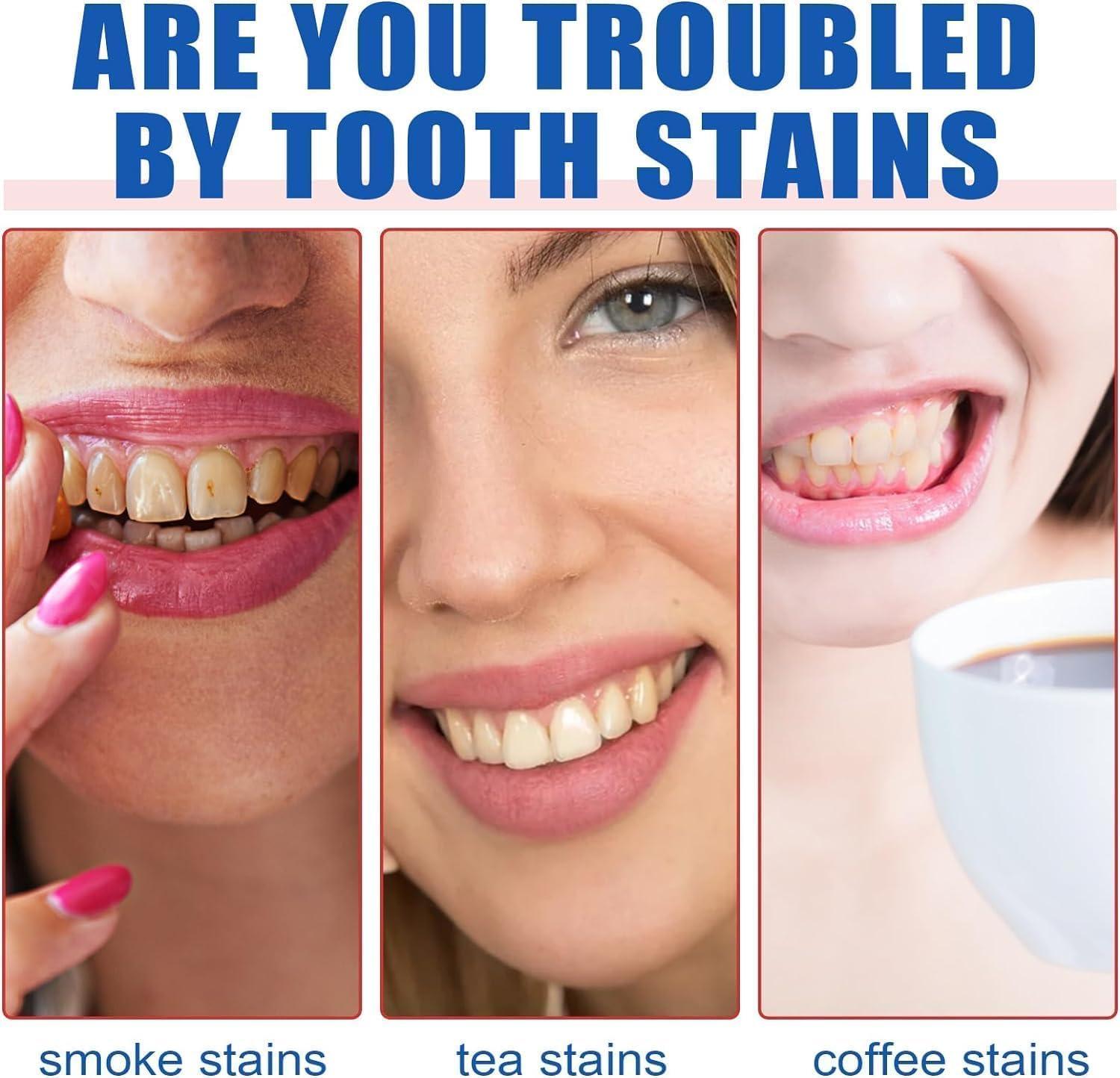 Generic New Sp-6 Toothpaste, Brightening & Stain Removing Toothpaste, Sp-6 Probiotic Whitening Toothpaste, Sp-6 Teeth Whitener Toothpaste, Natural Tooth Whitener, 30g - (Pack of 1)