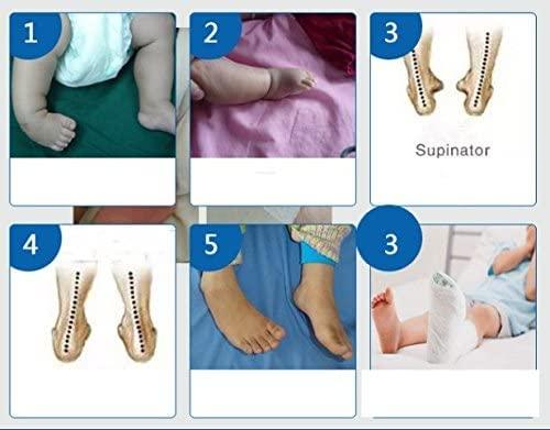 SALO Orthotics SALO Orthotics Unisex Ctev Splint Clubfoot Shoe Medical Surgical Shoe-(3\", RIGHT)