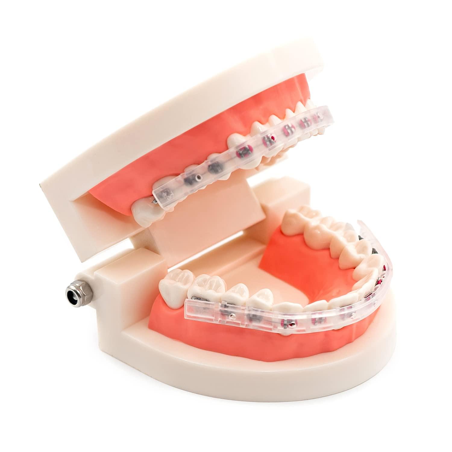 AIM DENTAL SUPPLY AIM DENTAL SUPPLY Lip Protector for Braces Orthodontic & Dental Pain-Relief Comfort Lip Shield Mouth Guard Custom FIT Brace Covers by AIM DENTAL SUPPLY Dental Supply 2.0 Count