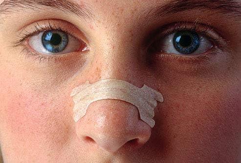 Dazzliq Dazzliq Nasal Strips, Open Your Nose Breathe Better And Sleep Better, Nasal Strips To Reduce Snoring, Congestion From Colds And Allergies Anti Snoring Device Men & Women Improves Sleep- 10 Pcs