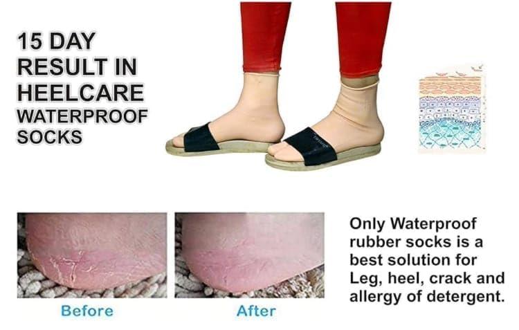 4Mura 4Mura waterproof Rubber Socks, Anti Crack Gel Heel Ankle Length And Foot Protector Moisturizing Socks for Foot Care,Pain Relief for Men And Women(1 PAIR) (SKIN BROWN, LARGE)