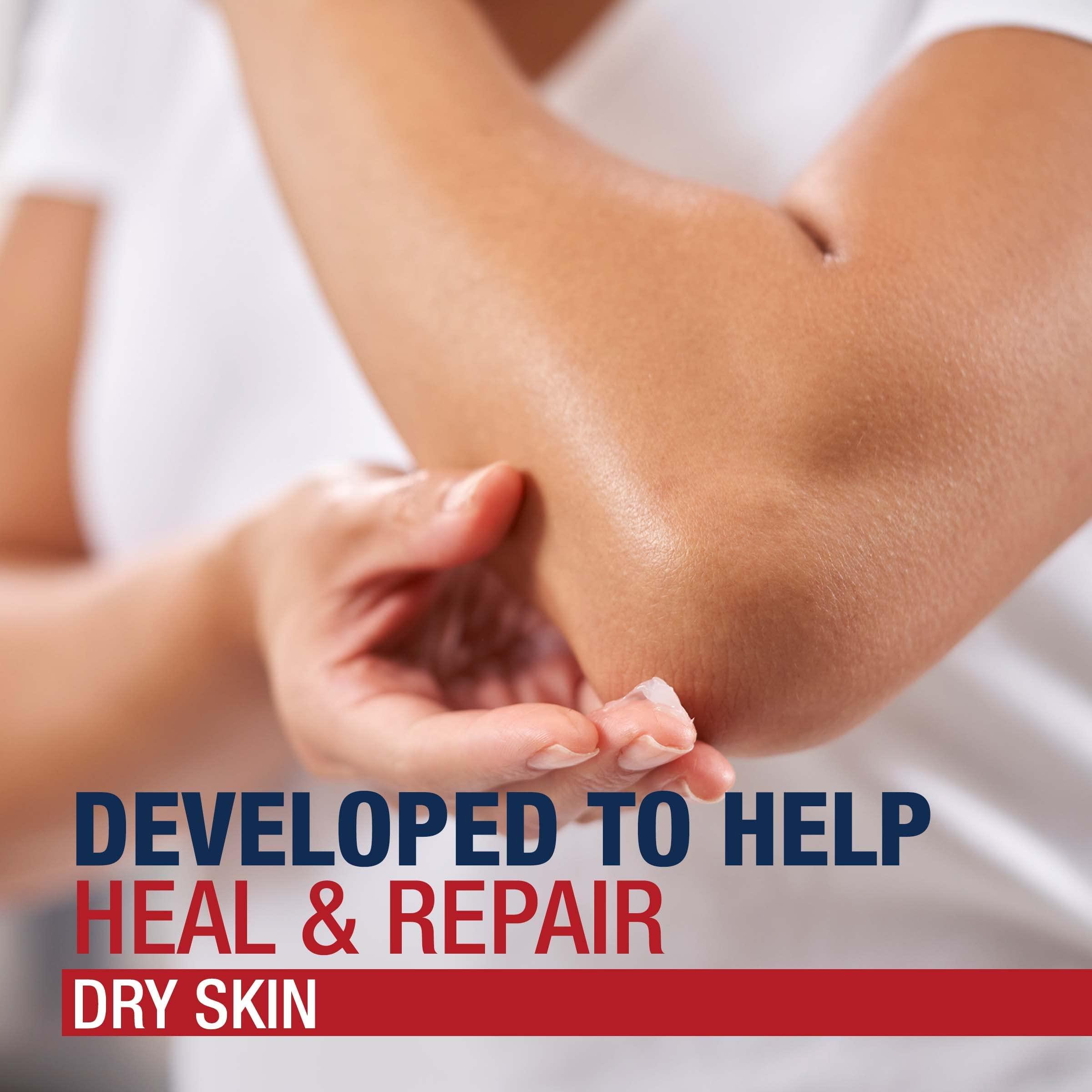 Aquaphor Aquaphor Healing Ointment, Dry, Cracked And Irritated Skin Protectant, 198g / 7oz