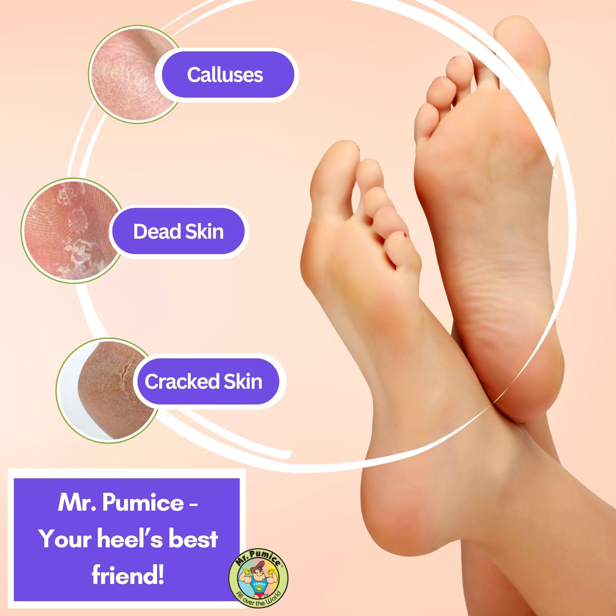 Mr. Pumice Mr. Pumice Ultimate Pumi Bar (4 Pack): 2-in-1 Callus Remover, Pedicure Stone & Ped File Scrubber for Smooth Feet and Heels, Dual-Grit (Medium + Coarse)