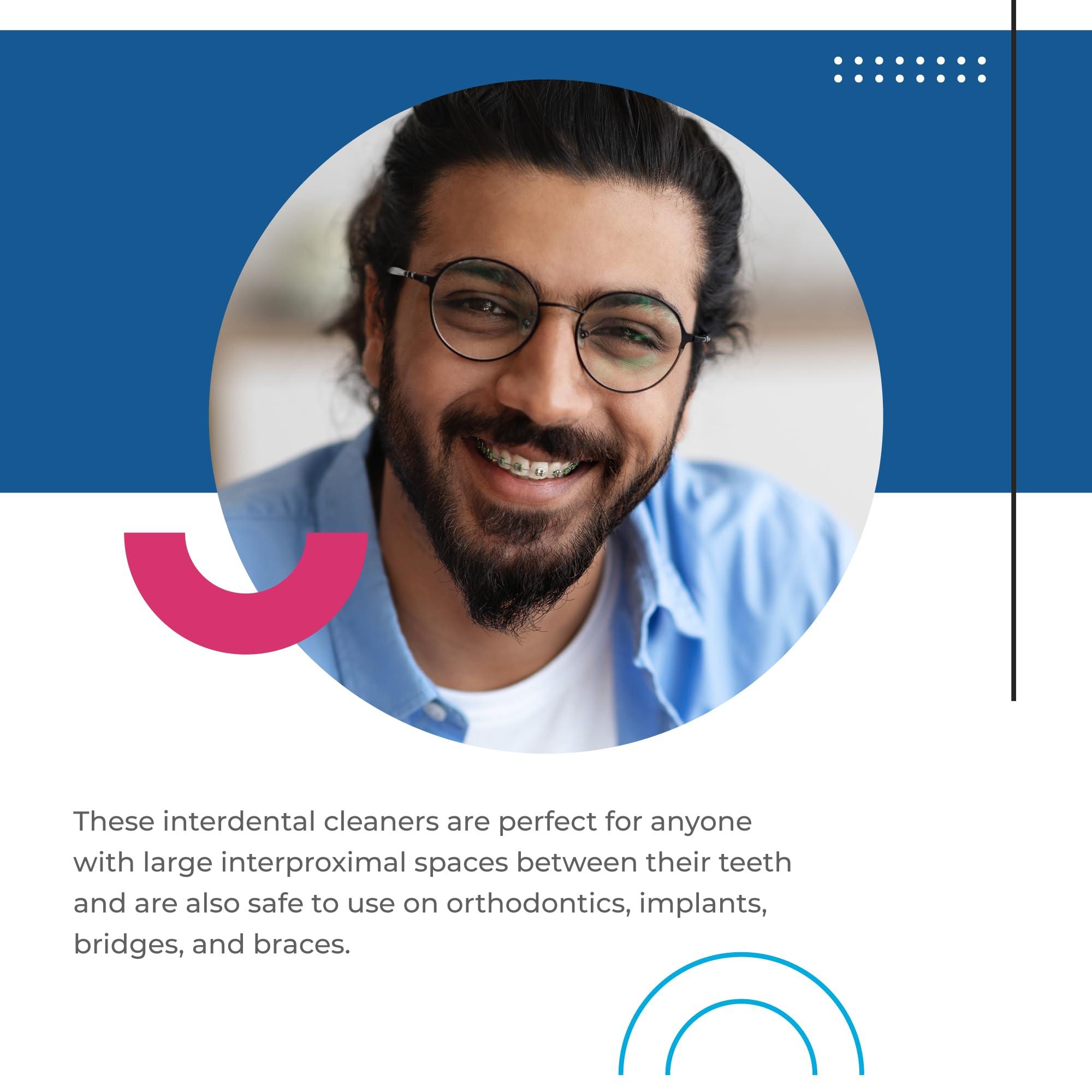 Tess Oral Health Tess Oral Health 260/205C Proxi-Tip Standard Handle + Proxi Tips