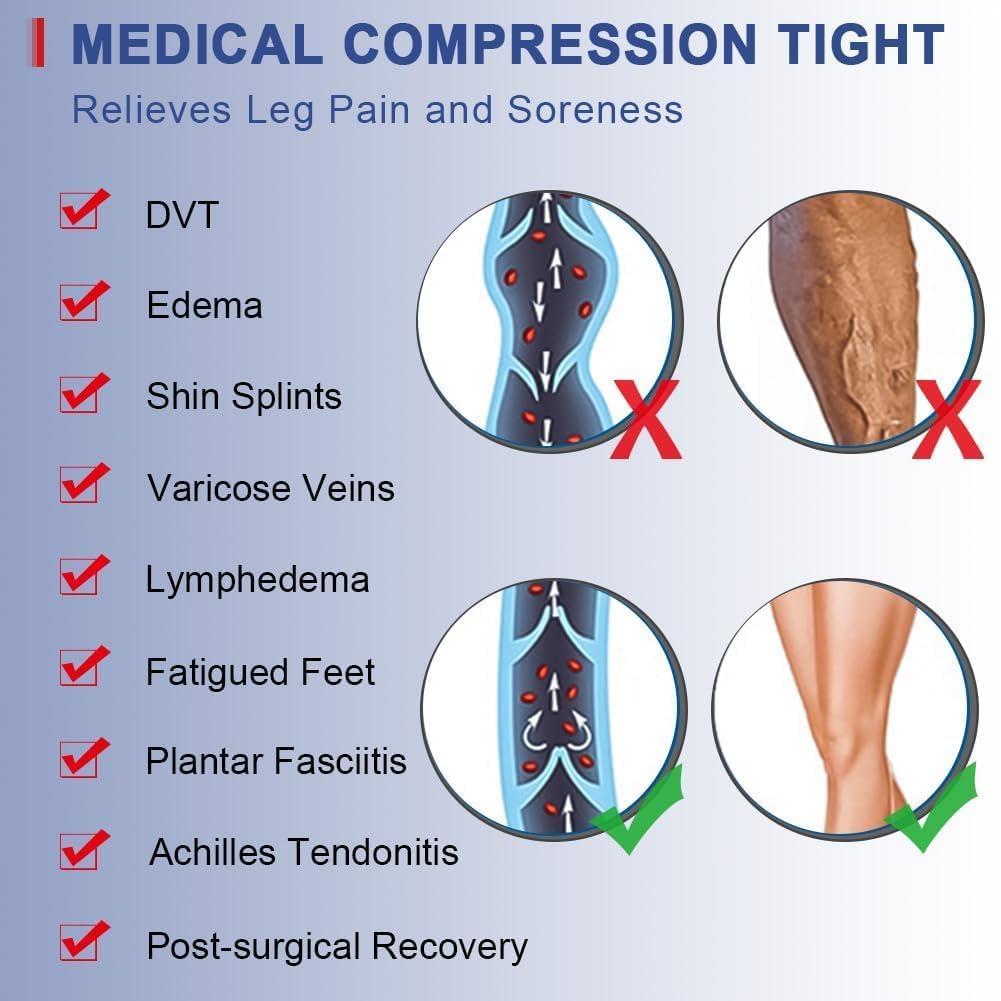 beister Medical Compression Tights for Women & Men, Open Toe Thigh High Pantyhose, 20-30mmHg Graduated Support (Beister), Black, Large