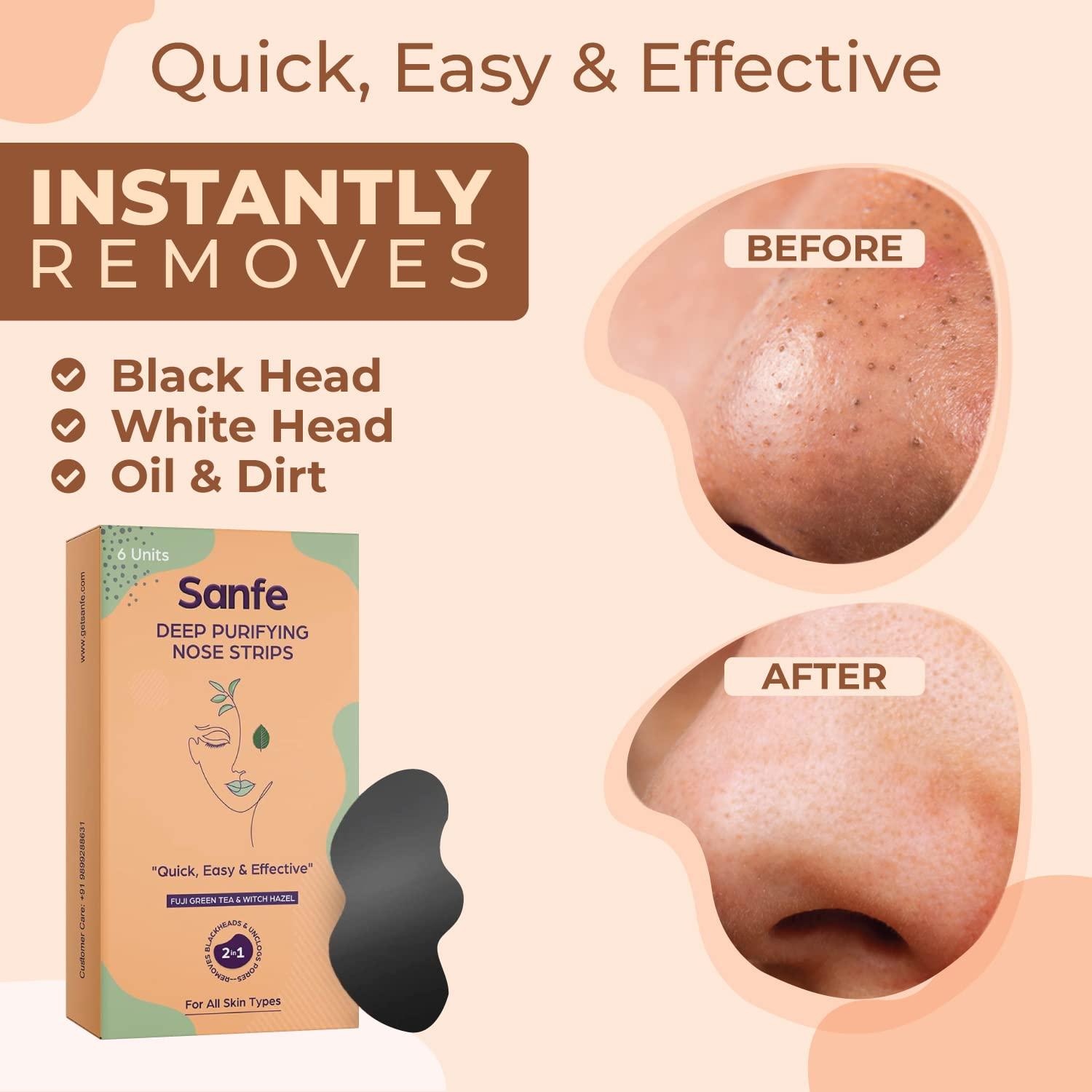 Sanfe Sanfe Deep Purifying Nose Strips for Women - Pack of 6 & Sanfe Pretty Face Razor for pain-free facial hair removal - Pack of 1, Firm Grip White, Medium