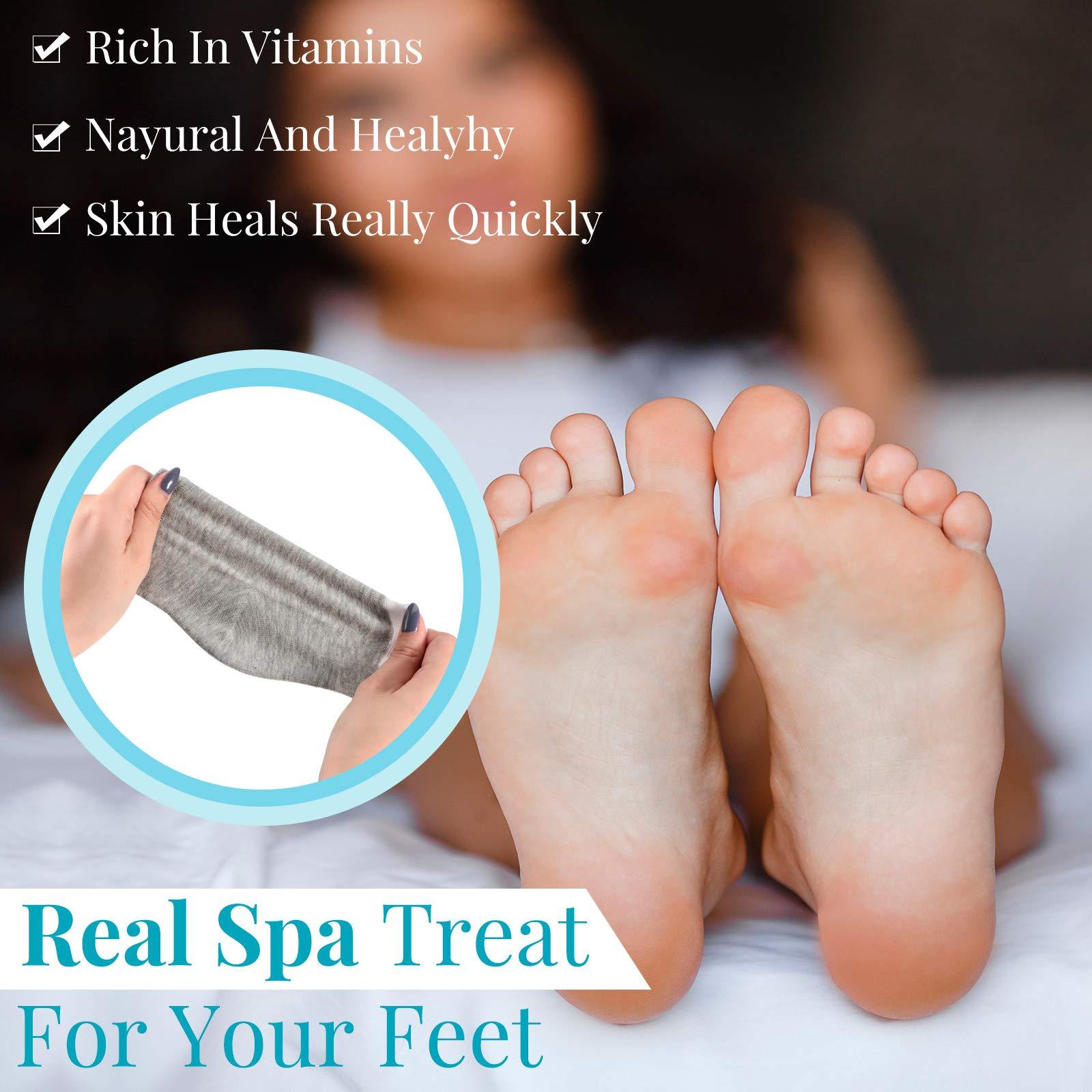 Geyoga Geyoga 2 Pairs Of Open-Toe Moisturising Gel Heel Socks, Spa Sock For Men Or Women Foot Care, Cracked Heels, Dry Feet, Foot Calluses, Dead Skin, Black, Grey
