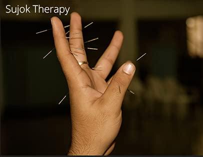 ACUPRO HEALTH CARE SYSTEM ACUPRO HEALTH CARE SYSTEM _Acs acupuncture needle sujok needle dry needling for physio therapy combo set of size Acs (25x0.13mm, 25x0.25mm) 200 needles total 2 Box