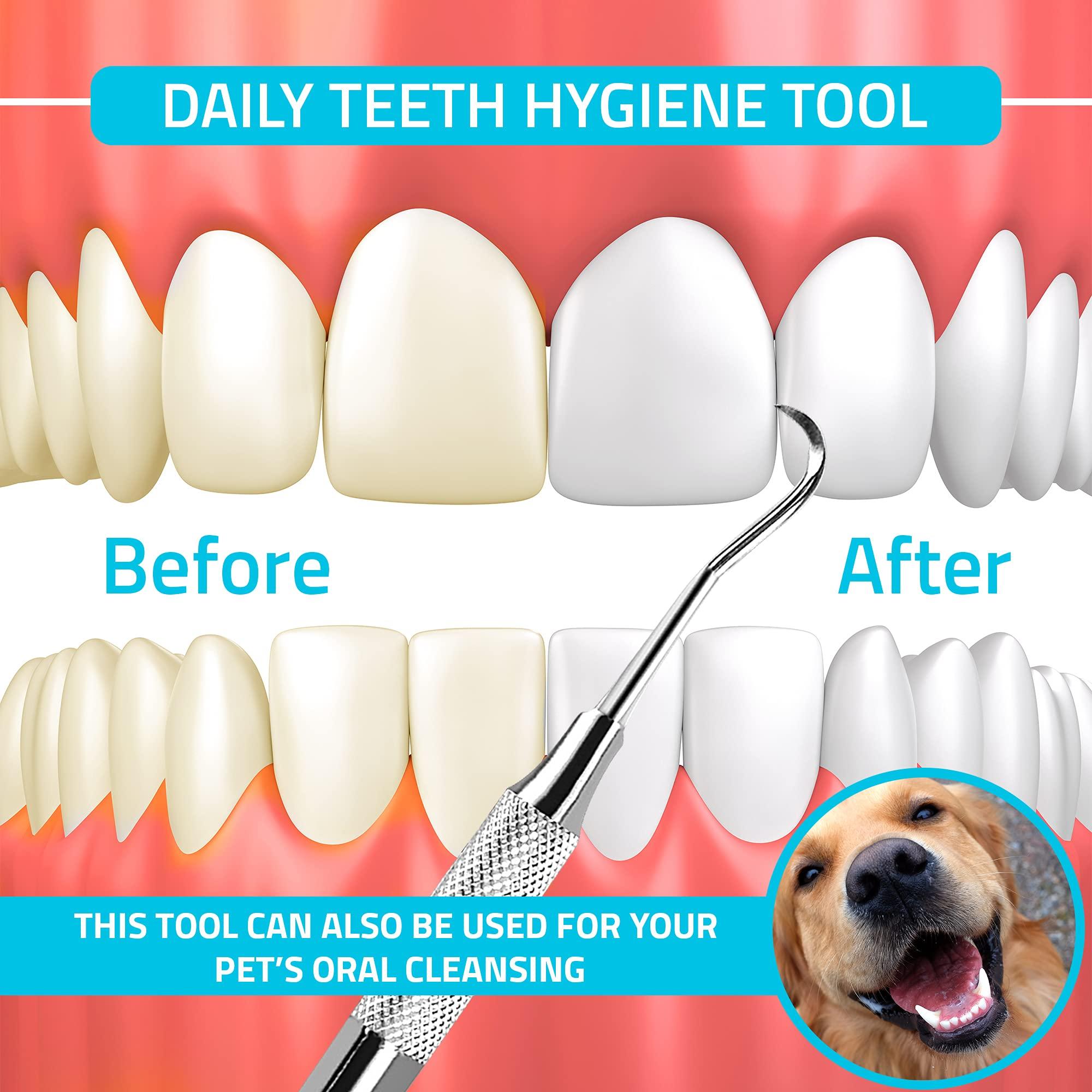 Utopia Care Utopia Care Professional Dental Tartar Scraper Tool - Dental Pick, Double Ended Tartar Remover for Teeth, Plaque Remover, Tooth Scraper (6 Inch, Silver, 1)