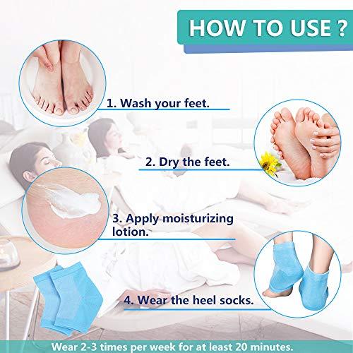 JUMPOW Moisturizing Socks, Moisturizing/Gel Heel Socks for Dry Cracked Heels, Open Toe Socks, Ventilate Gel Spa Socks to Heal and Treat Dry, Gel Lining Infused with Vitamins